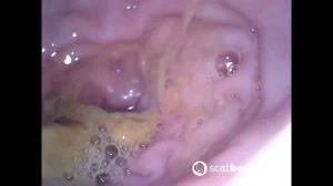 Show Inside Of My Ass With Endoscope (FullHD 1080p / 378 MB) 26 May 2025
