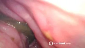 Endoscope In My Ass (FullHD 1080p / Scat, Dirty Anal)