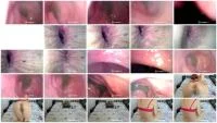 Endoscope In My Ass (FullHD 1080p / 647 MB) - ScatUria