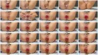 Dirtiest Anus Prolapse Part 1 (HD 720p / 4.51 MB) - ScatUria