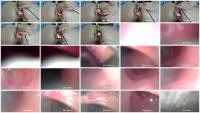 Gape With Speculum (FullHD 1080p / 118 MB) - ScatUria